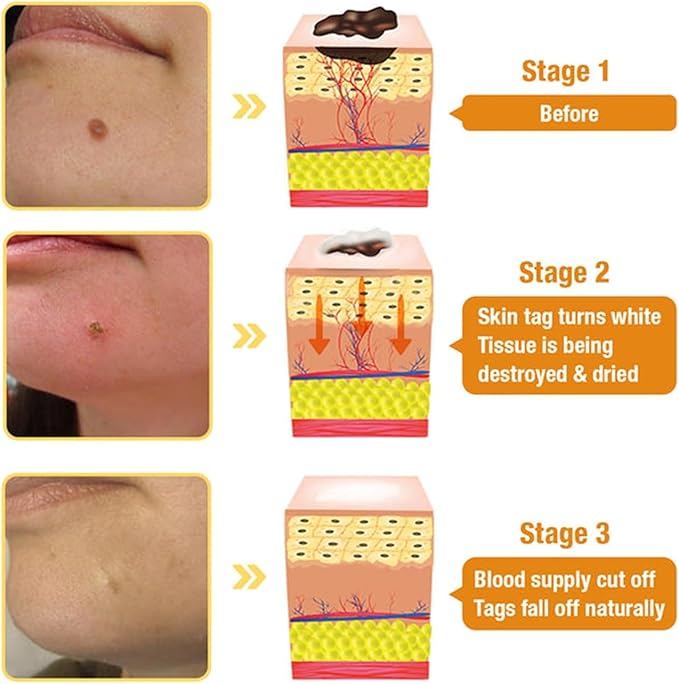 Bee Venom Skin Treatment Cream (2PCS) – Maximum Strength Repair for All Skin Types
