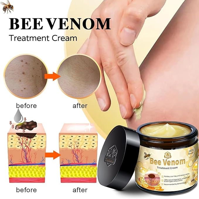 Bee Venom Skin Treatment Cream (2PCS) – Maximum Strength Repair for All Skin Types