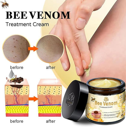Bee Venom Skin Treatment Cream (2PCS) – Maximum Strength Repair for All Skin Types